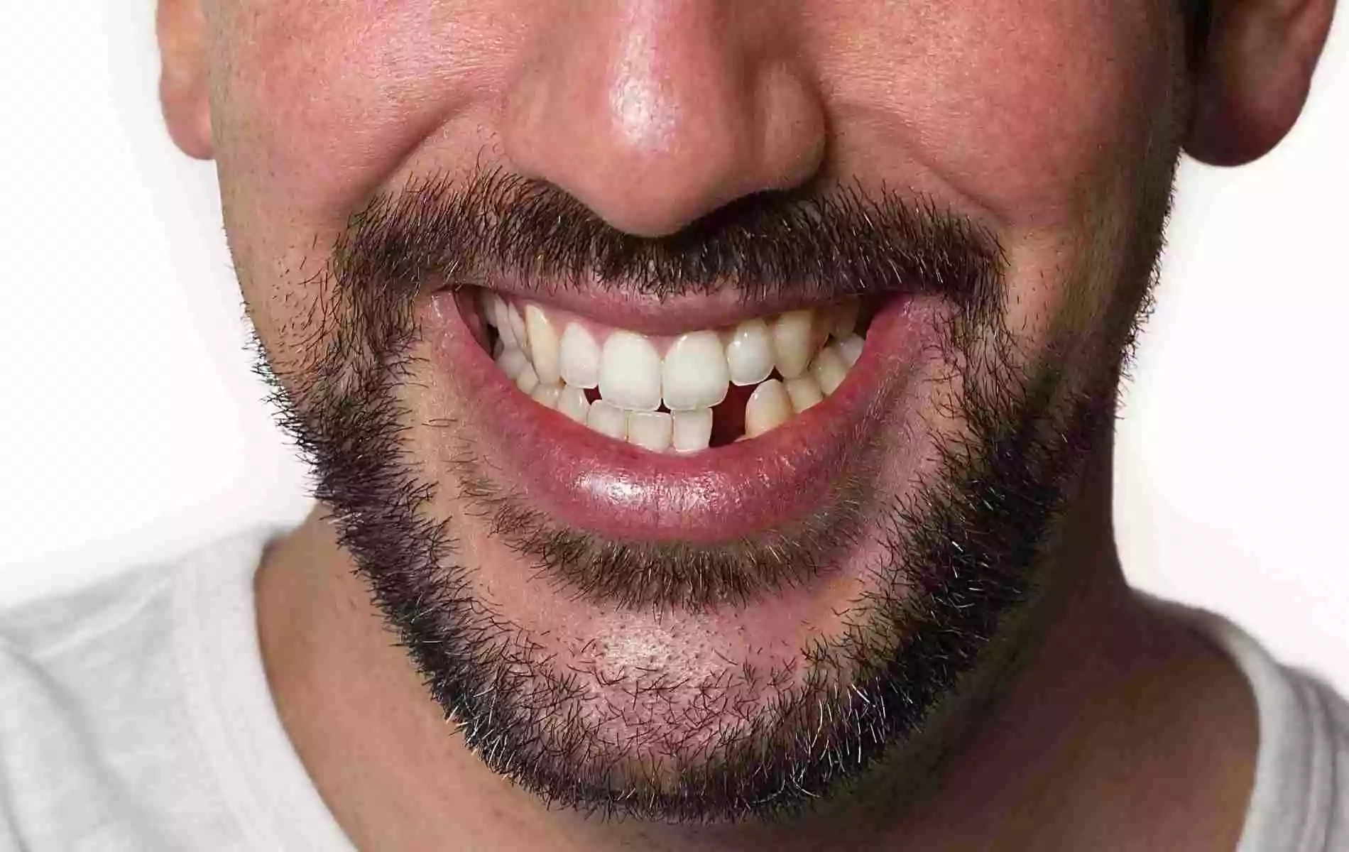 تفسير رؤية سقوط الأسنان .. للمتزوجة والعزباء والرجل 9